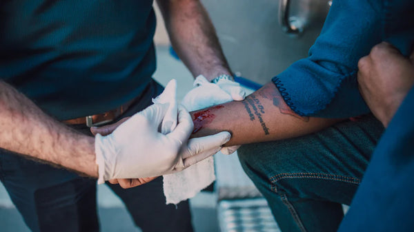 Treating Open Wounds: An Essential Guide to First Aid